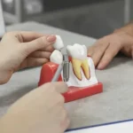 Dental Implants In Dallas