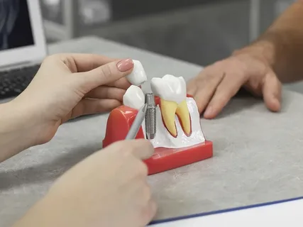 Dental Implants In Dallas