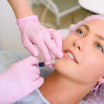 Dermal fillers treatment for restoring facial volume naturally